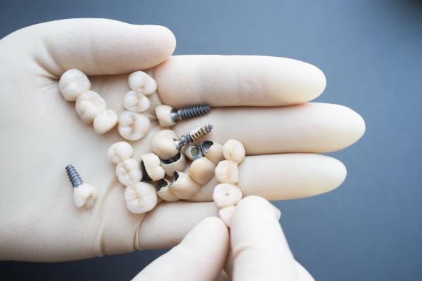 Dental Restoration Options For Damaged, Decayed, Or Missing Teeth