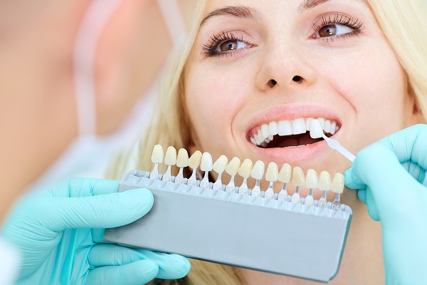 Three Reasons To Consider Dental Veneers