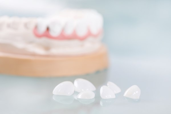 What Happens During A Dental Veneers Procedure