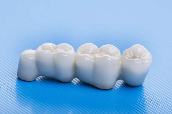 How Many Teeth Can Dental Bridges Replace from Casas Adobes Dentistry in Tucson, AZ
