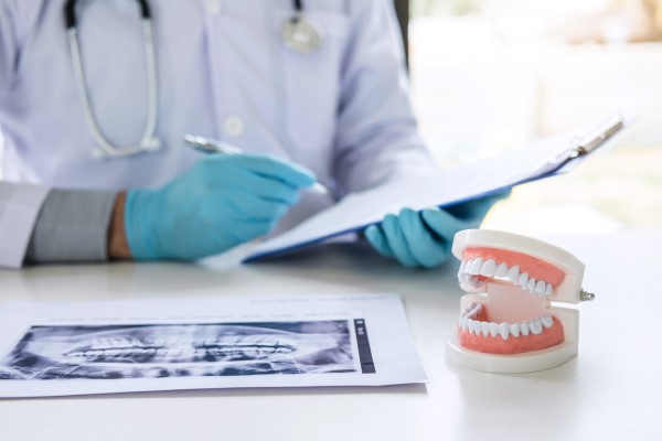 Tips To Prepare For Your Oral Cancer Screening