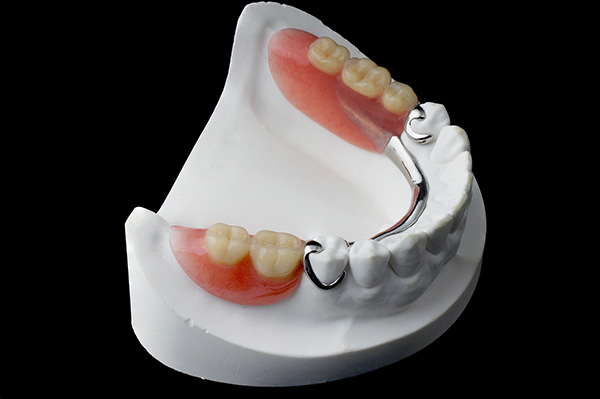 Options For Replacing Missing Teeth: Are Partial Dentures Easier To Care For Than Dentures?