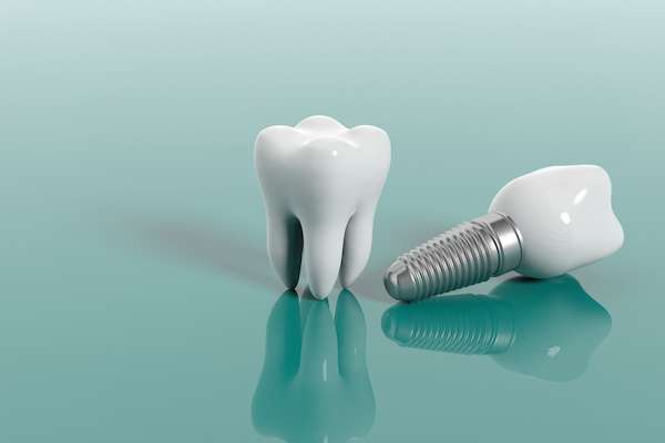Multiple Teeth Replacement Options: One Implant for Two Teeth from Casas Adobes Dentistry in Tucson, AZ